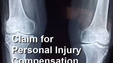 Claim for Personal Injury Compensation