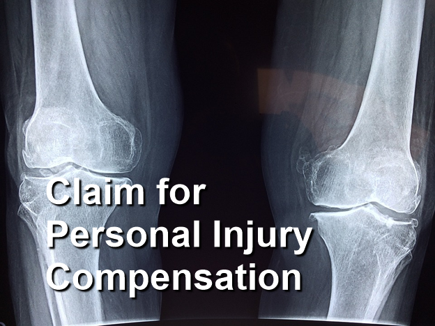 Claim for Personal Injury Compensation