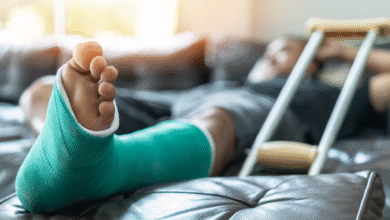 Slip and Fall Injuries