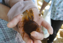 Poor Hygiene Standards Lead to Health Risks