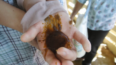 Poor Hygiene Standards Lead to Health Risks