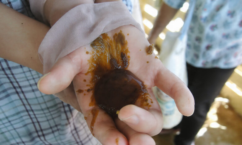 Poor Hygiene Standards Lead to Health Risks